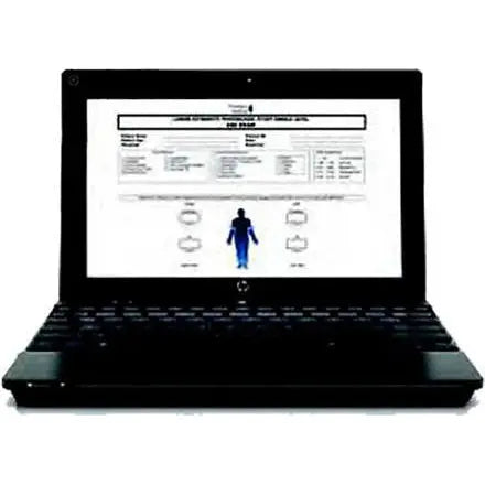 Acer Computer for simpleABI Systems - 1