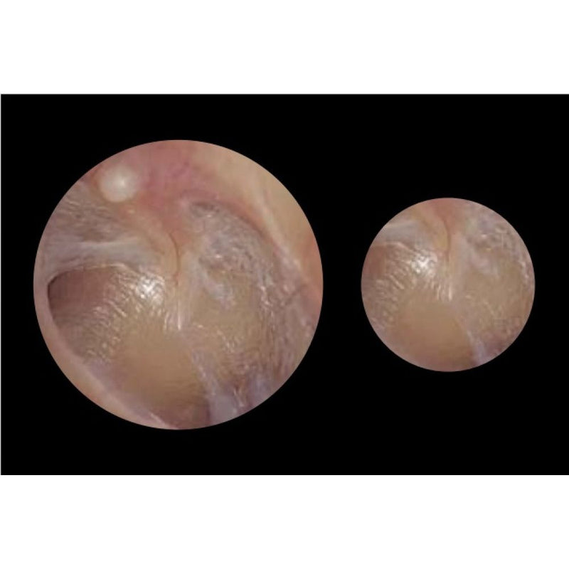 ADC Diagnostix 55802 3.5V PMV Otoscope/Coax Plus Ophthalmoscope Diagnostic Desk Set 