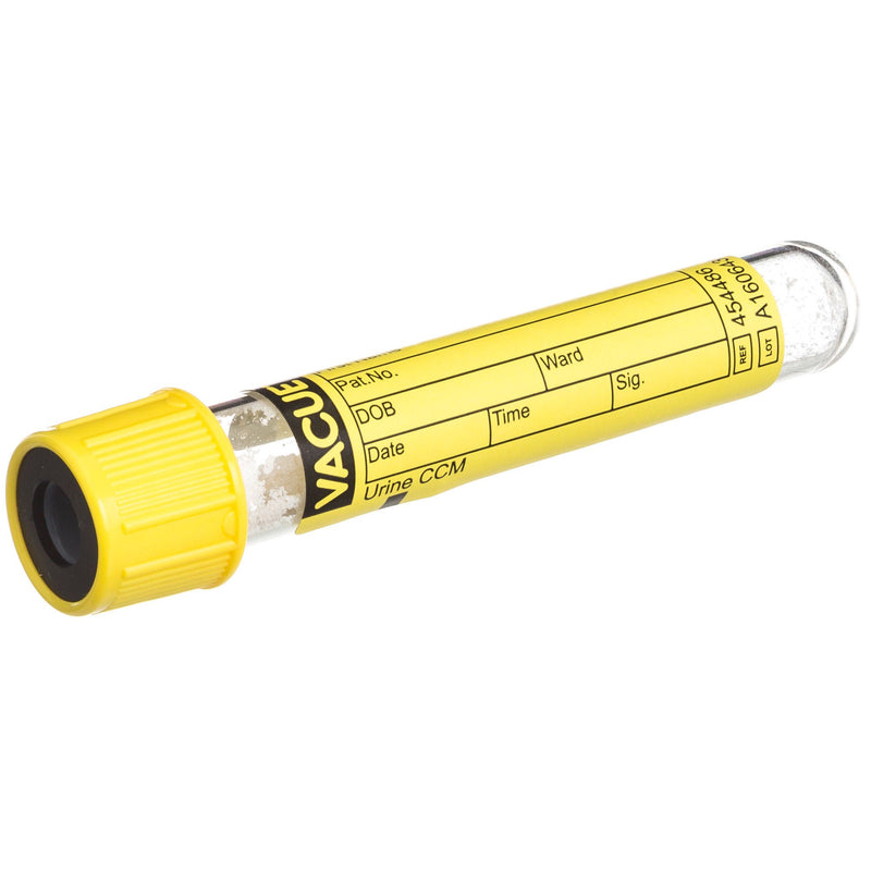 Vacuette Urinalysis Tube, 4 mL, 13 x 75 mm (Case of 1200)