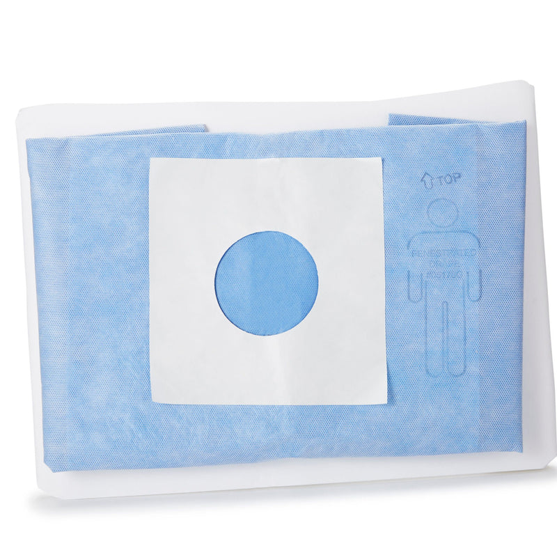 McKesson Sterile Minor Procedure Drape, 48 x 60 Inch (Case of 20)