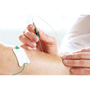 Ambu Neuroline Concentric EMG Needle Electrode in use