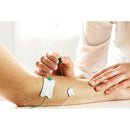 Ambu Neuroline Monopolar EMG Needle Electrode In Use