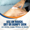 Hand and Body Moisturizer Gold Bond Rough and Bumpy Skin 8 oz. Jar Unscented Cream (Each)