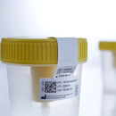 Greiner Bio-One Urine Specimen Container with Integrated Transfer Device 100 mL (3.4 oz.) Screw Cap Patient Information Sterile (300/CS) 