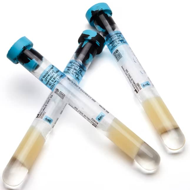 BD Vacutainer Mononuclear Cell Preparation Tube [CPT] (60/Case)  CPT Sodium Citrate Tube, 13 mm x 100 mm x 4.0 mL