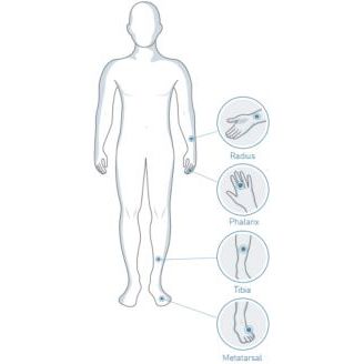BeamMed Sunlight MiniOmni Ultrasound Bone Sonometer - Measurement Sites