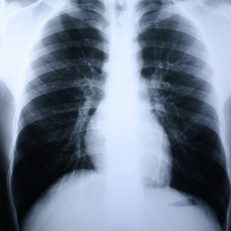 Clear Choice Performance X-Ray Film (Case of 500)