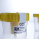 Greiner Bio-One Urine Specimen Container with Integrated Transfer Device 100 mL (3.4 oz.) Screw Cap Patient Information Sterile (300/CS)