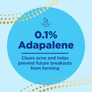 Differin Gel Acne Treatment (Each)