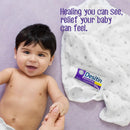 Desitin 40% Zinc Oxide Diaper Rash Ointment Maximum Strength Paste, 2 oz. Tube (Each)