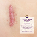 Emerson Healthcare Mederma Scar Cream Plus SPF 30 