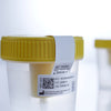 Urine Specimen Container with Integrated Transfer Device 100 mL (3.4 oz.) Screw Cap Patient Information Sterile (Case of 300)