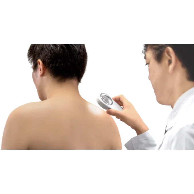 Casio Dermoscope Set In Use
