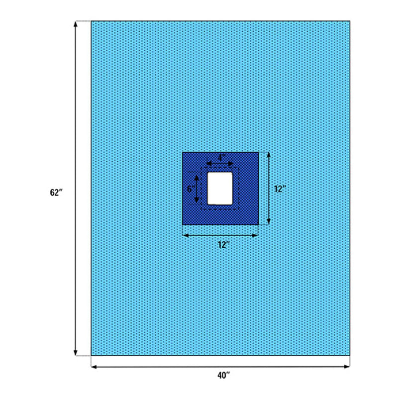 Welmed Sterile Fenestrated Drape, 40 x 62 Inch (Case of 60)