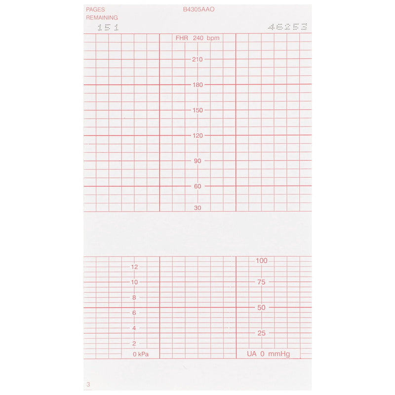 McKesson Fetal Monitoring Paper (6400/CS) 