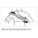 Chattanooga Sully Shoulder Stabilizer 