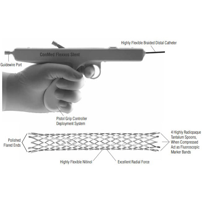 ConMed Flexxus Endoscopic Biliary Stent diagram