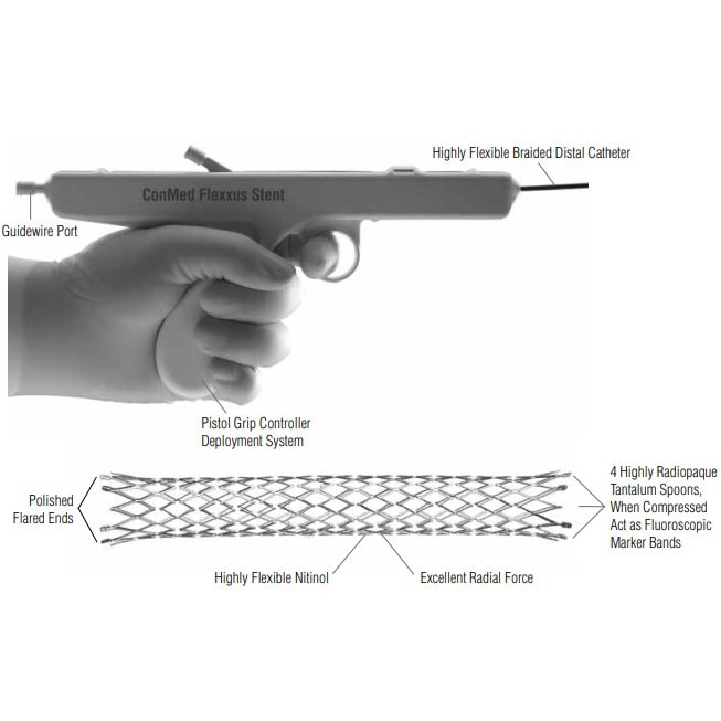 ConMed Flexxus Endoscopic Biliary Stent 