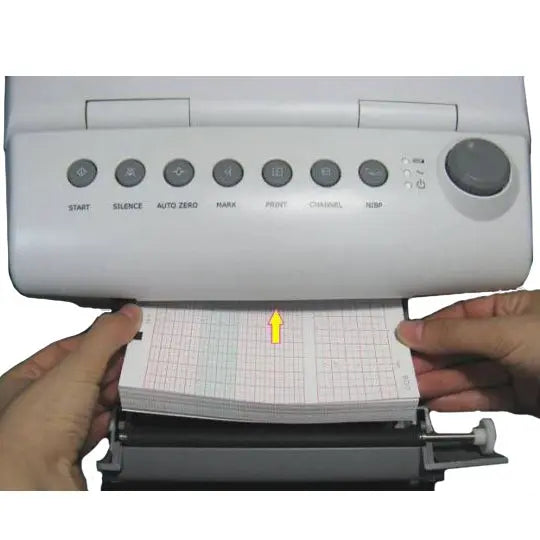 CooperSurgical F9 Fetal Monitor Recording Paper