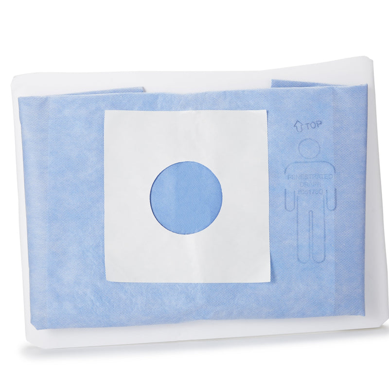 McKesson Sterile Minor Procedure Drape, 48 x 60 Inch (Case of 20)