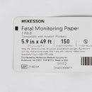 McKesson Fetal Monitoring Paper (150/PK)