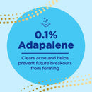 Differin 0.1% Adapalene Gel Acne Treatment, 45-gram Pump Bottle (Each)