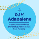 Differin 0.1% Adapalene Gel Acne Treatment, 45-gram Pump Bottle (Each) 