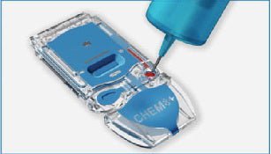 Dispensing Tip i-STAT For i-STAT Handheld Blood Analyzer (Pack of 100)