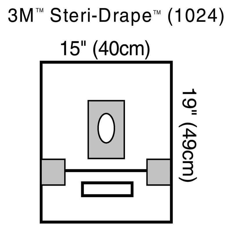 Solventum Corporation 3M Steri-Drape Sterile Small Aperture EENT Drape, 15 x 19 Inch (40/CS) 