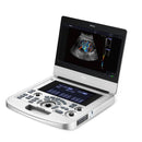 Edan Acclarix AX2 Compact Color Doppler Ultrasound System