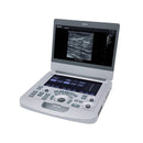 Edan Acclarix AX3 Compact Color Doppler Ultrasound System Angled