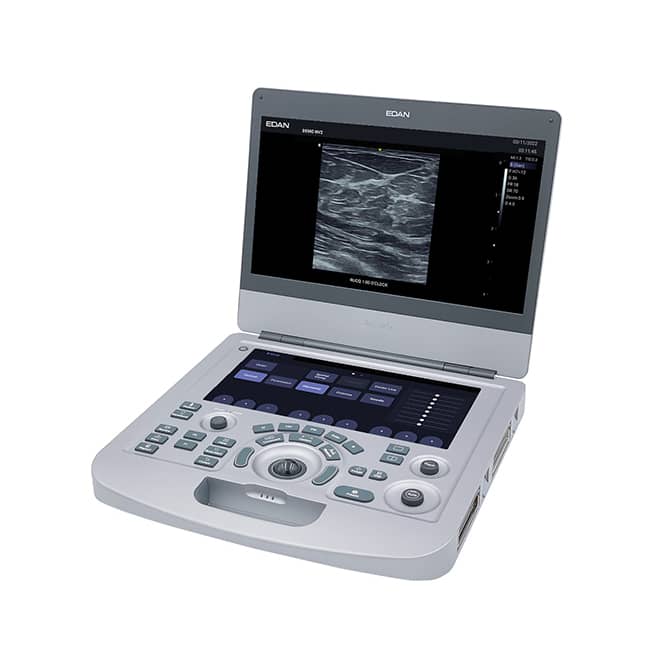 Edan Acclarix AX3 Compact Color Doppler Ultrasound System Angled