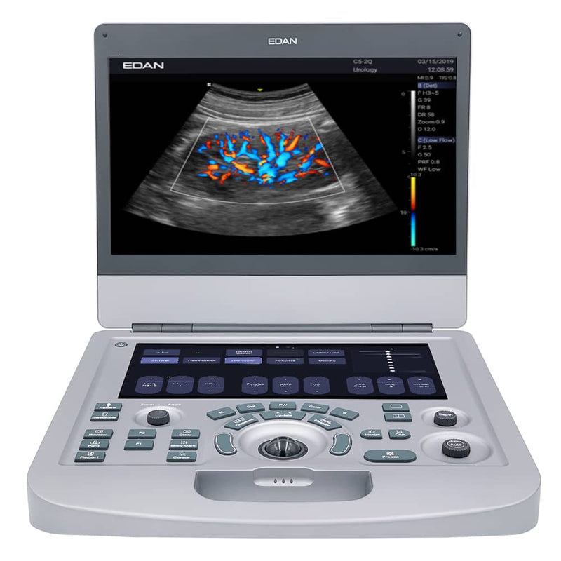 Edan Acclarix AX3 Compact Color Doppler Ultrasound System