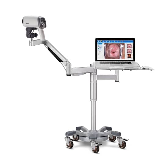 Edan C6A HD Video Colposcope  with Swing Arm, PC Tray, and Laptop