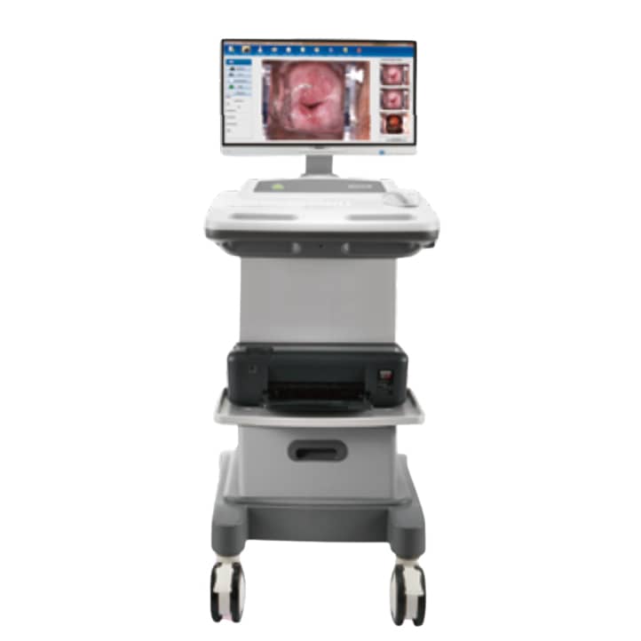 Edan C6A HD Video Colposcope  with Swing Arm and PC Tray