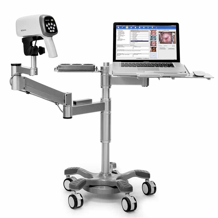 Edan C6A Video Colposcope  With Swing Arm and PC Tray