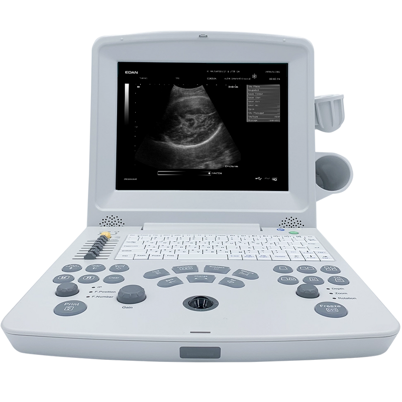 Edan DUS60 Ultrasound