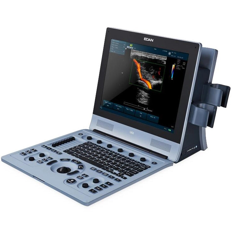 Edan U60 Color Doppler Ultrasound