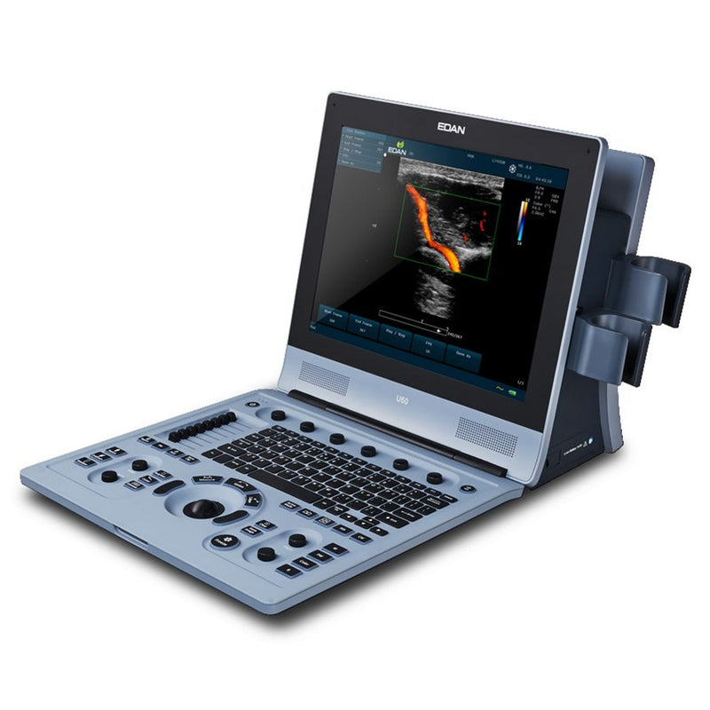 Edan U60 Color Doppler Ultrasound