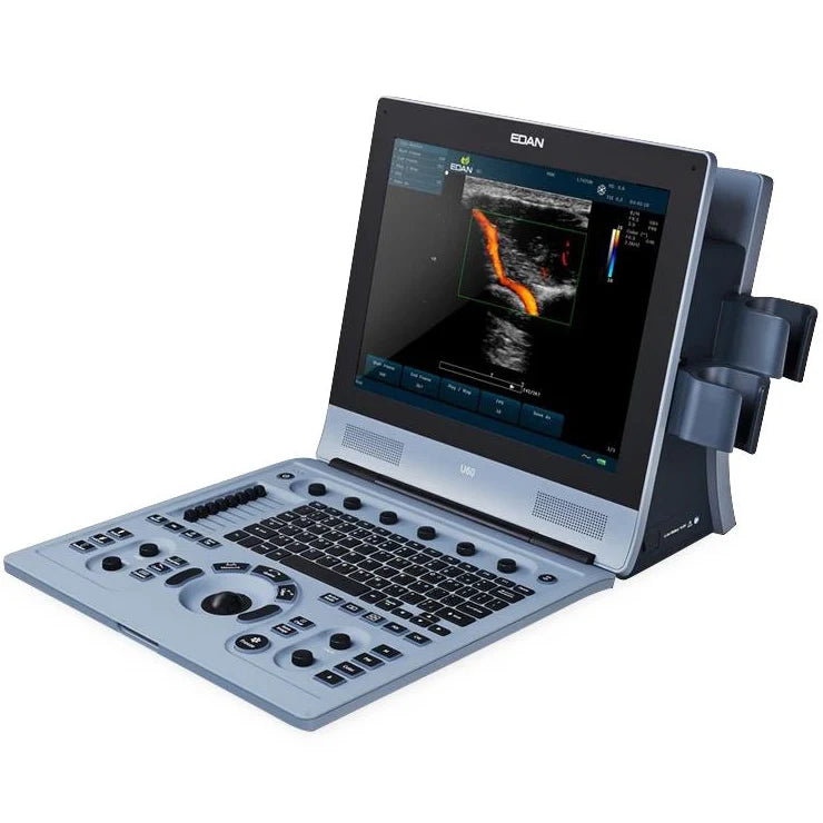 Edan U60 Color Doppler Ultrasound