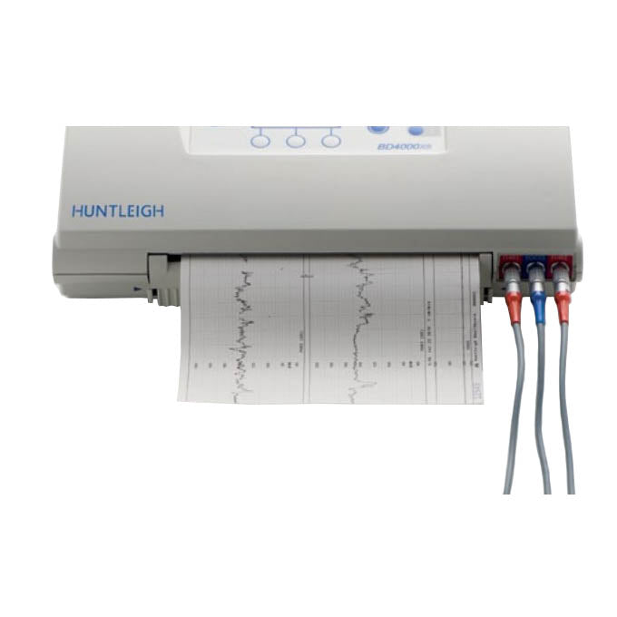 Huntleigh Sonicaid BD4000xs Thermal Printer Paper (10/Case)  Twins Width