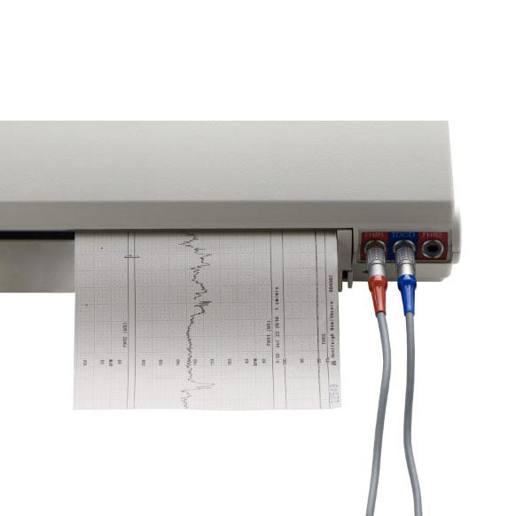 Huntleigh Sonicaid BD4000xs Thermal Printer Paper (10/Case)  Single Width