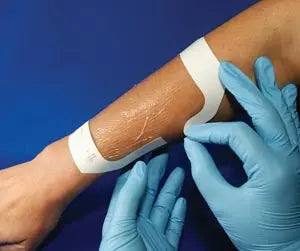 DRESSING TRANSPARENT WOUND4X4 50/PK 4PK/CS
