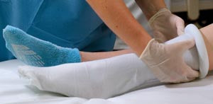 Alba Sterile Pre-Cut Stockinette