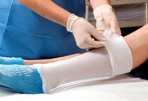 Albahealth, Llc Alba Non-Sterile Anti-Microbial Polyester Stockinette  89230 - Stockinette, 3" x 25 yds, Tubular, Anti-Mi