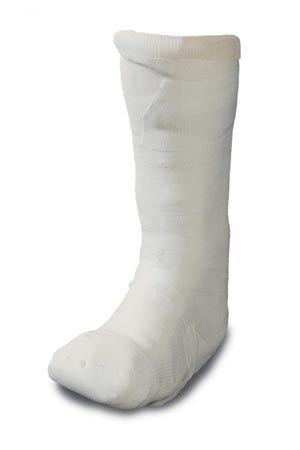 Integra Lifesciences, Corp Integra Lifesciences Mede-Kast Total Contact Casting System  Casting System: Primary Dressing,Tan Stockinette,T