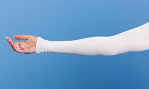 Medi-Tech International Corp Medi-Tech International Spandanette Stockinette