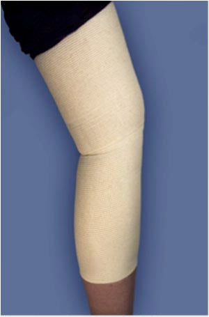 Medi-Tech International Corp Medi-Tech International Spandagrip  Bandage, (G) Natural, Lrg. Thighs, 4-1/2"x36", 12/