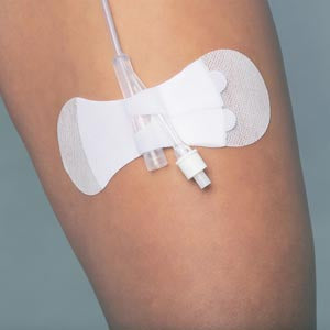 Tidi Products, Llc Tidi Grip-Lok Foley Securement Device 