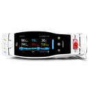 Masimo Radical-7 Pulse Oximeter